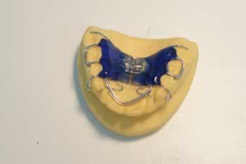 BIOBLOC dental device