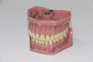 grinding teeth treatment Cork