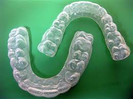 orthodontic Retainer
